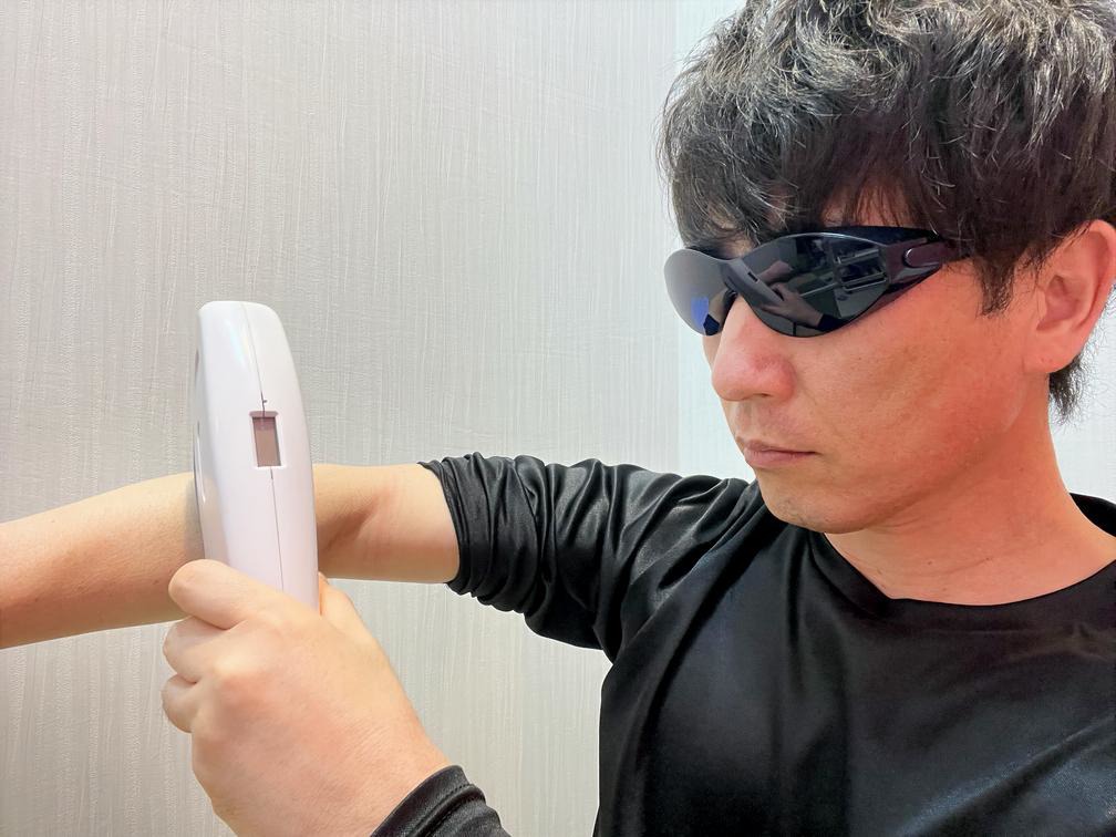 K-nacks セルフ脱毛の様子